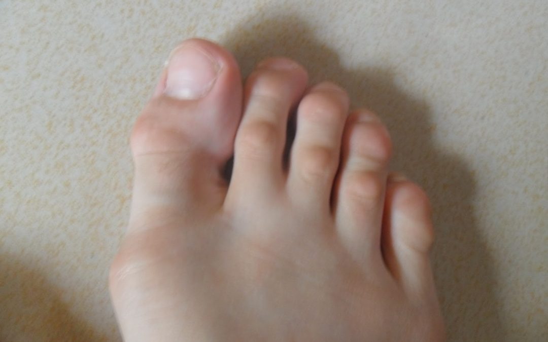 Top Tip #9 – Hammer Toes and Pointe Work